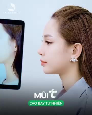 Mũi đẹp đón đại lễ