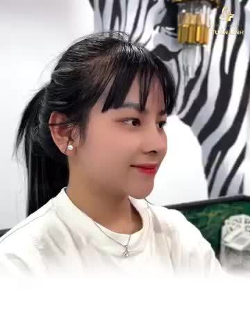 Thăng hạng nhan sắc chỉ sau 10 ngày nâng mũi cấu trúc Surgiform tại Tuấn Linh!!