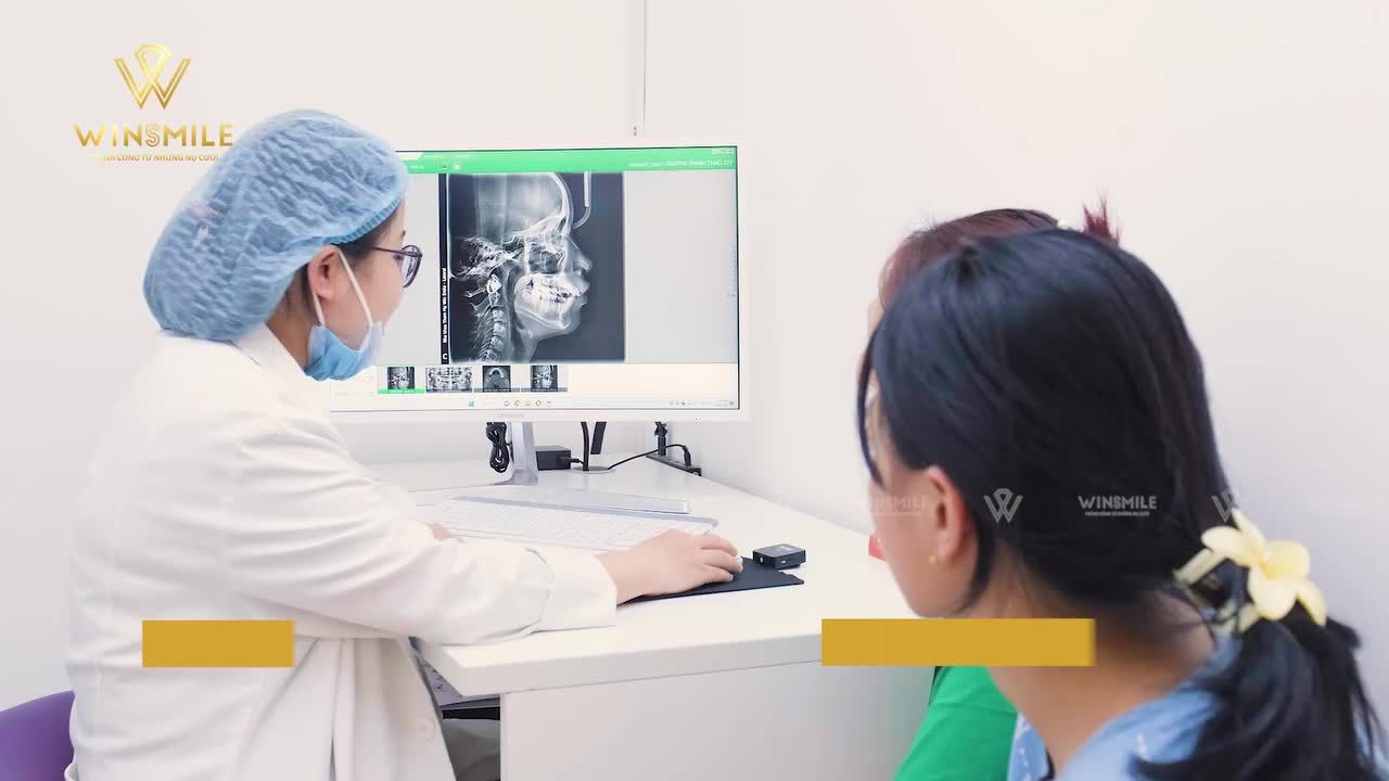 RĂNG THƯA, KHỚP CẮN SÂU   ĐIỀU TRỊ SỚM VỚI PHÁC ĐỒ NIỀNG RĂNG KHÔNG NHỔ RĂNG