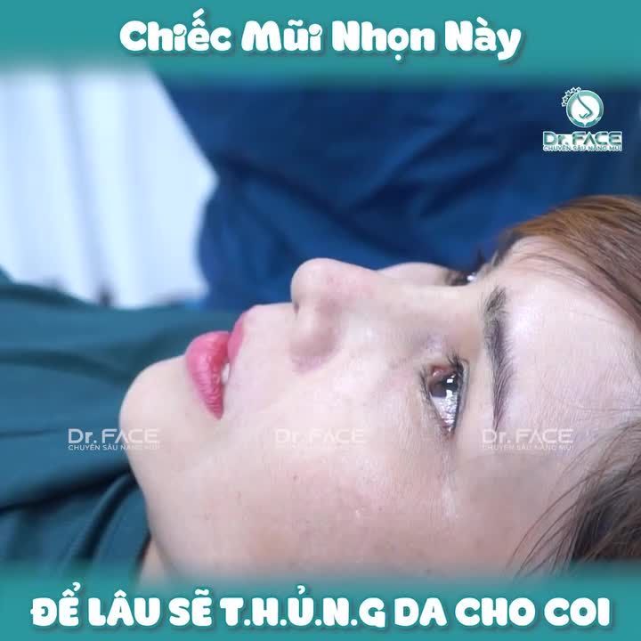Chiếc Mũi Nhọn Này Để Lâu Sẽ Thủng Da Cho Coi