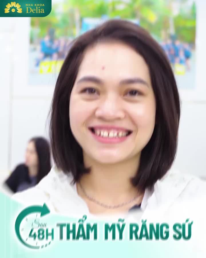 RĂNG THƯA - Ố VÀNG KHÔNG CÒN LÀ NỖI LO!