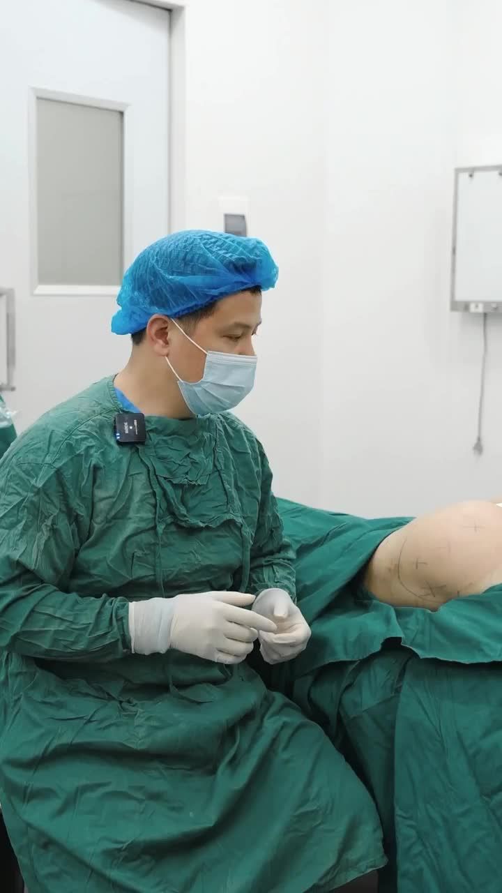 Khi nào thì chọn nâng mông bằng mỡ tự thân và khi nào chọn nâng mông bằng túi độn?