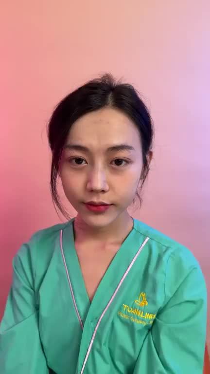 COMBO NÂNG MŨI + ĐỘN CẰM đẹp xuất sắc cho bạn khách đến từ An Giang!!