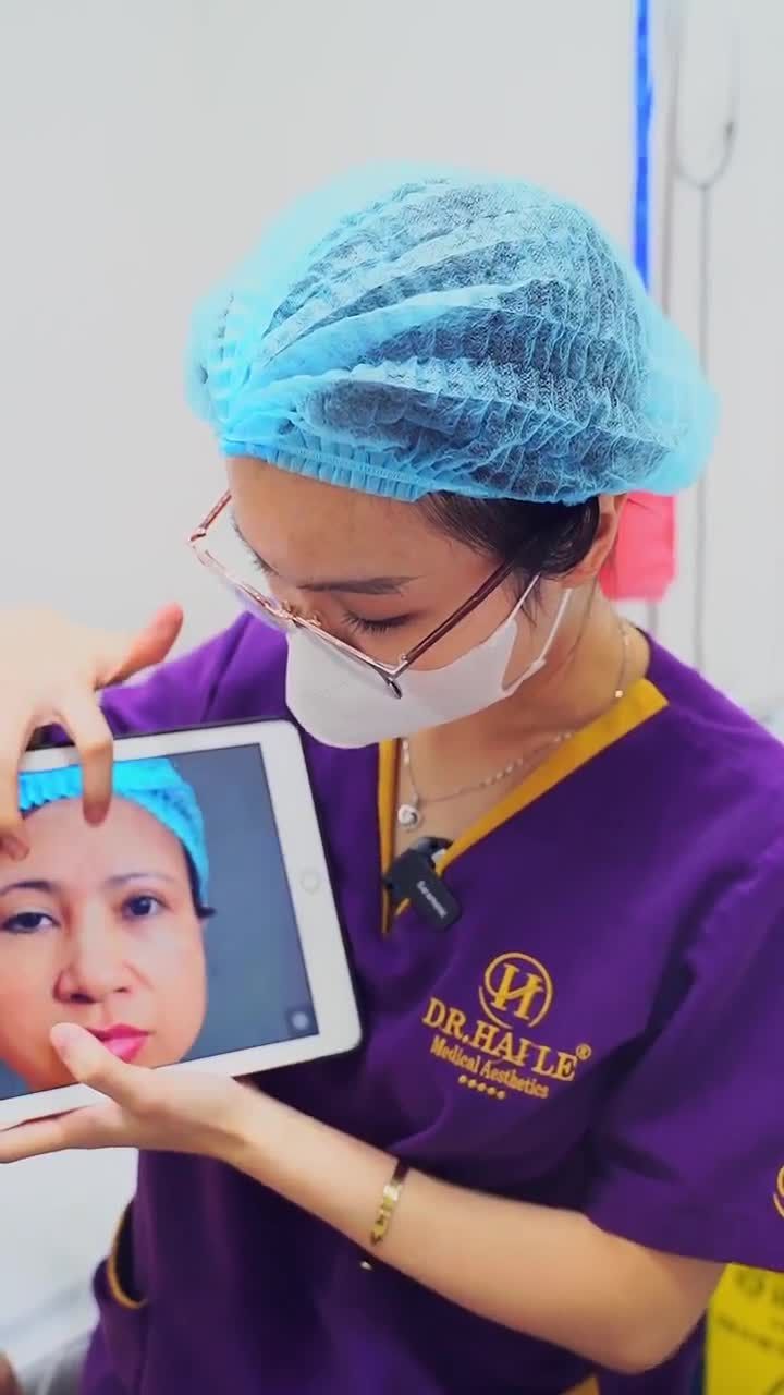 Phẫu thuật chỉnh hình mí bệnh lý bẩm sinh Dr.Hải Lê, sở hữu đôi mắt tự tin chỉ sau 1 giờ 30 phút!
