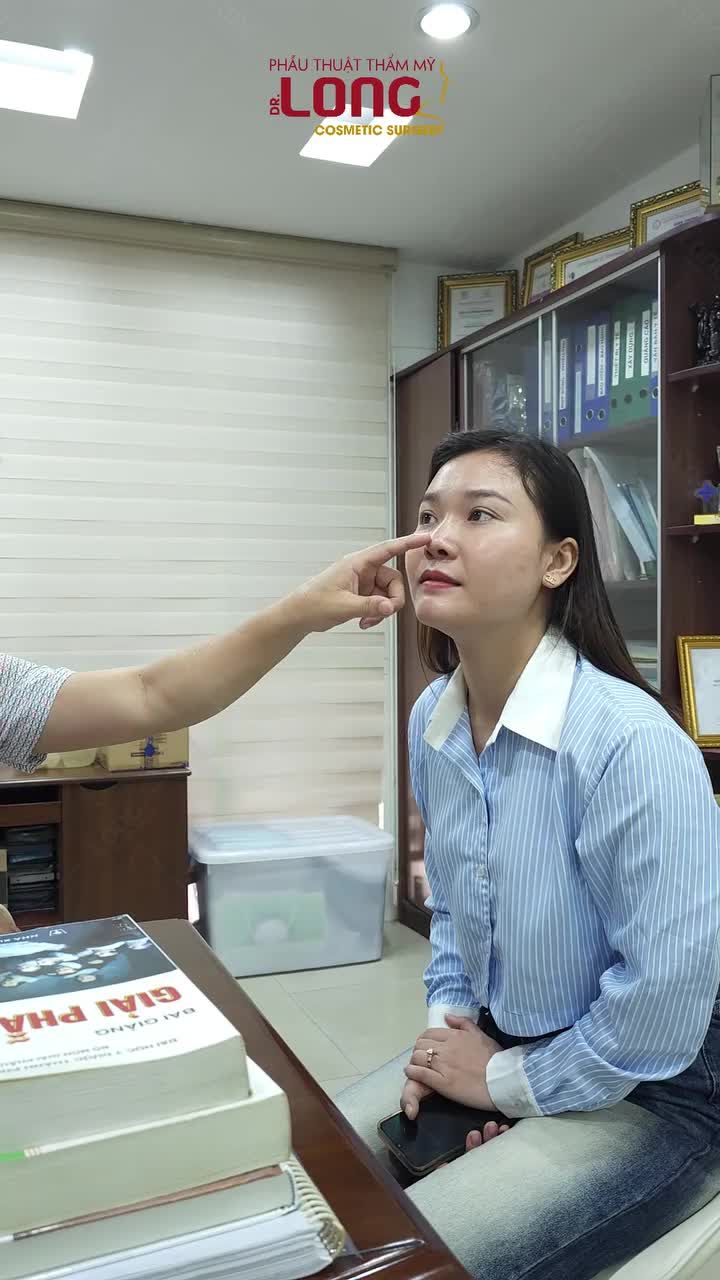 DÁNG MŨI CỦA HIỆN TẠI SAU KHI NÂNG 10 THÁNG