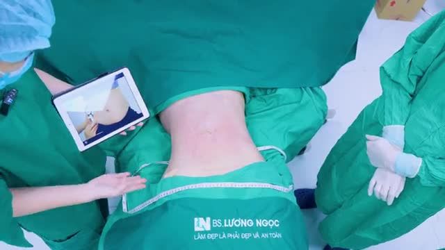 Eo thon thắt đáy lưng ong Da bụng phẳng lì đẹp mắt Đường cong body quyến rũ