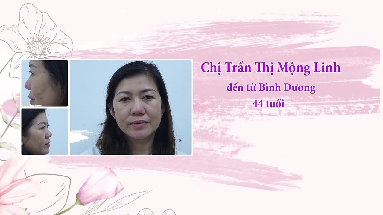 CUỘC SỐNG KHÓ KHĂN KHIẾN NHAN SẮC PHAI TÀN THEO NĂM THÁNG