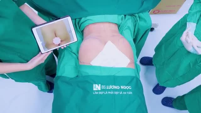 Không còn teo tóp, hõm lép như trước, V3 chị S đã trở nên căng tròn, đầy đặn tự nhiên tạo nên đường cong body cuốn hút.