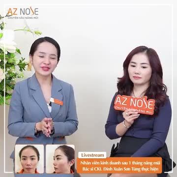 Nhân viên kinh doanh chia sẻ sau 1 tháng nâng mũi cấu trúc