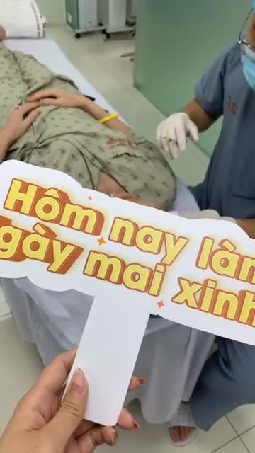 Ca căng chỉ + làm đầy thái dương