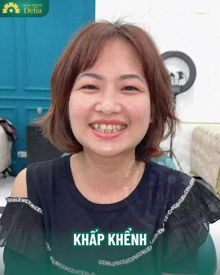 Bỏ qua lời ngăn cản ""đừng làm răng sứ" của chị gái - Và cái kết?