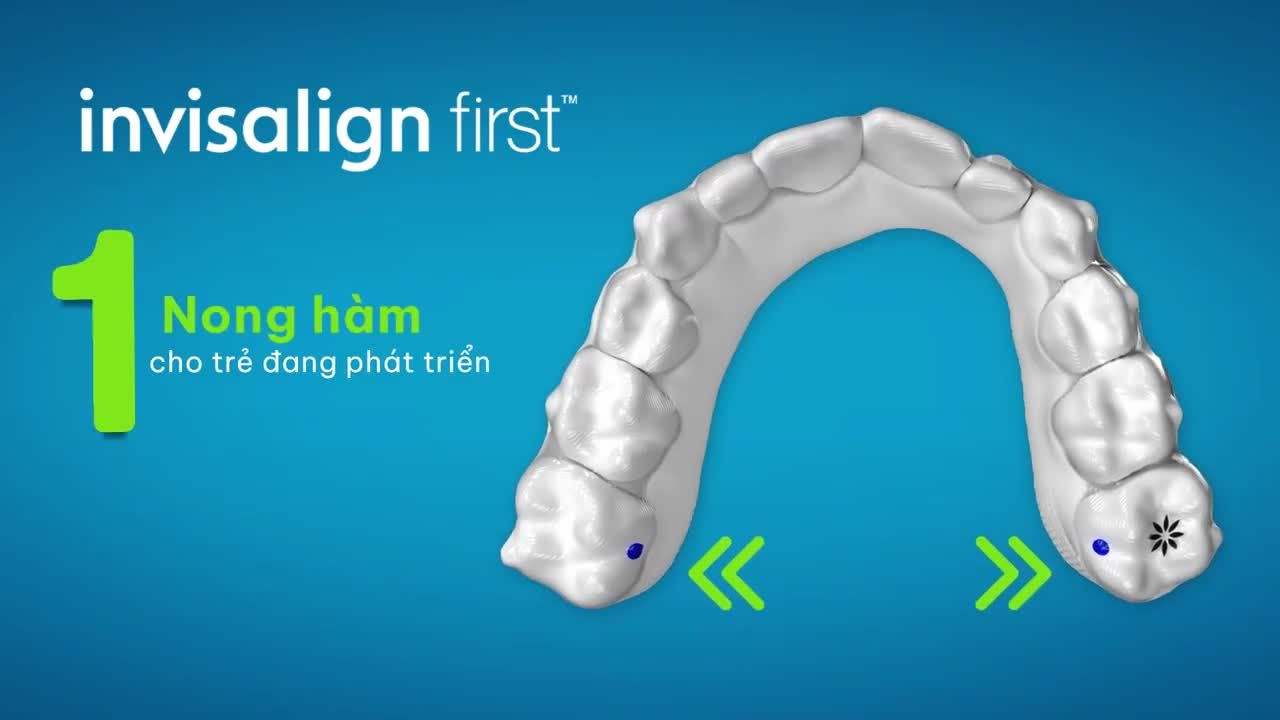 TIỀN CHỈNH NHA INVISALIGN CHO BÉ TỪ 7 TUỔI