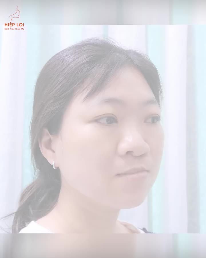 Lột xác "ngoạn mục" cùng BS Phan Hiệp Lợi - Chuyên gia đầu ngành phẫu thuật tạo hình thẩm mỹ