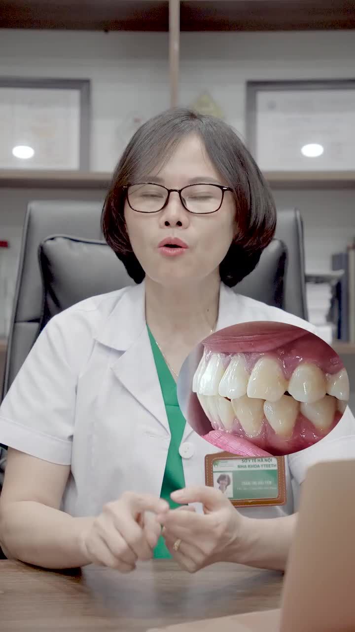 Niềng răng có hết lệch mặt không?