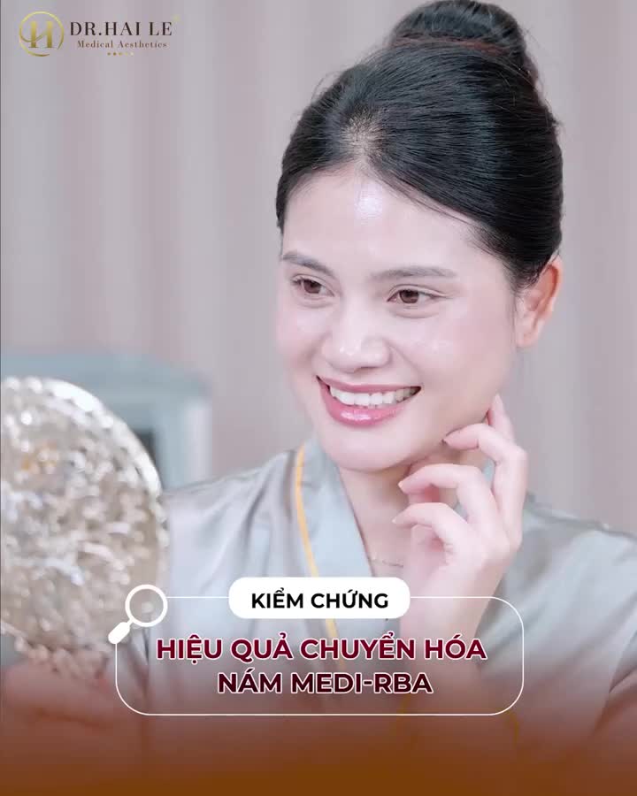 Vị khách hàng của chúng ta gặp phải tình trạng nám hỗn hợp kín mặt, đã thử nhiều phương pháp nhưng không đạt hiệu quả.