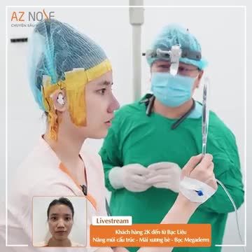 Khách hàng 2K đến từ Bạc Liêu nâng mũi cấu trúc, kết hợp bọc Megaderm