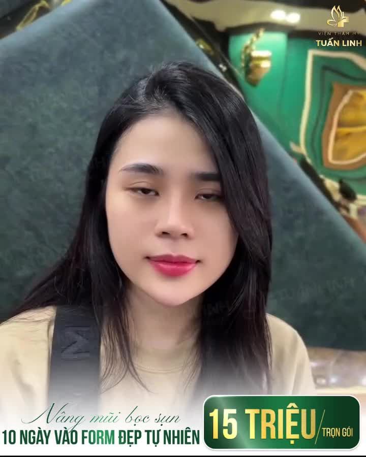 DÁNG MŨI QUỐC DÂN ĐẸP TỰ NHIÊN!!