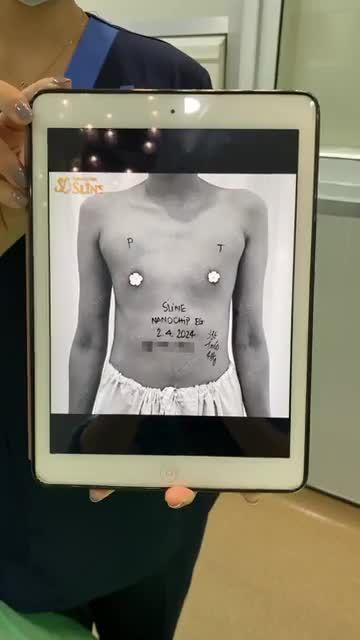 TRỌN 60P LOẠI BỎ V1 PHẲNG LÌ LẤY LẠI V1 SEXY