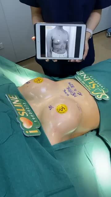 MỞ MÀN CA NÂNG NGỰC TRÒN CĂNG