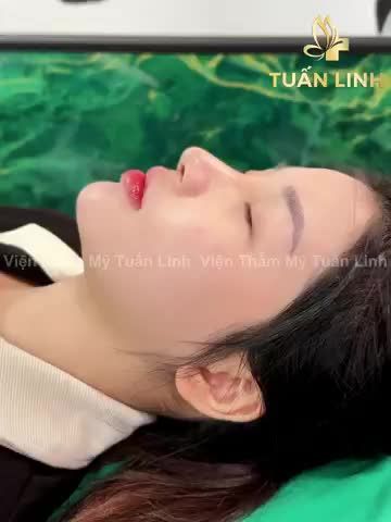 Xinh đẹp hơn chỉ với 15Triệu!!
