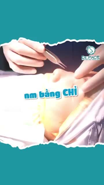 Oh My God RÚT CHỈ MŨI…