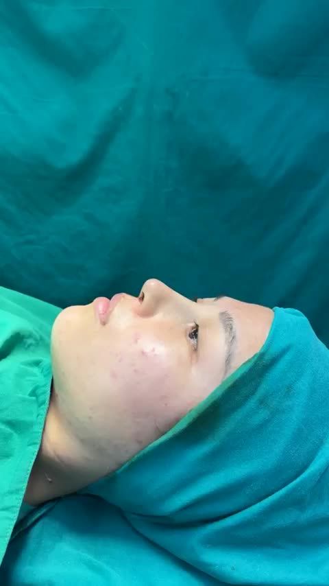 Case mũi cấu trúc vừa hoàn thành cho cô nàng 2K2!!
