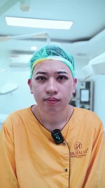 Kết quả phẫu thuật chỉnh hình mí bệnh lý bẩm sinh tại Dr.Hải Lê, theo dõi ngay!