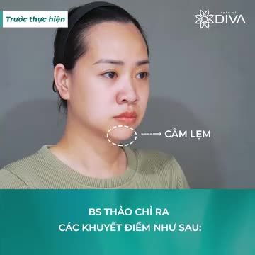 U40 HÓA U30 ĐẸP MỌI GÓC SAU THẨM MỸ