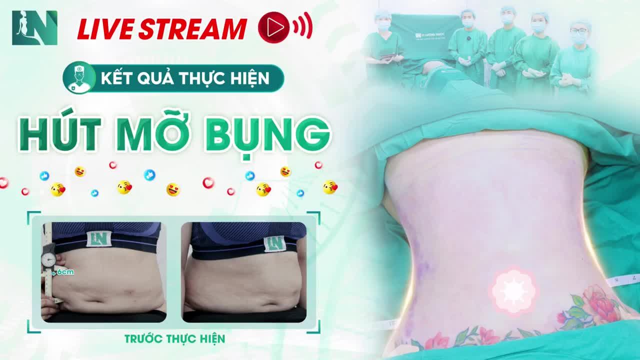 Hôm nay, ekip BS. Lương Ngọc đã tiếp nhận một trường hợp khó, do chị khách hàng đã từng thực hiện h.ú.t mỡ căng c.ắ.t da tại cơ sở không chuyên sâu và nhận lại kết quả thất vọng  - Mỡ bụng không giảm hết, thân hình không thon gọn thậm chí để lại sẹo 