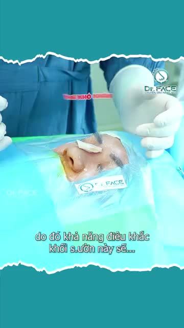 CĂNG QUÁ GẶP SỤN SƯỜN CỐT HÓA…