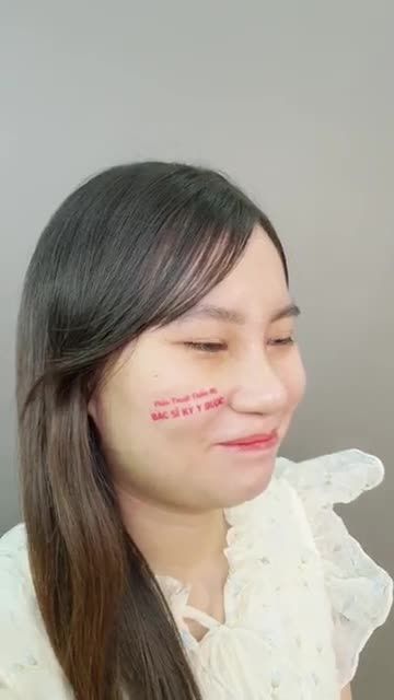 CHỈ 11 TRIỆU CHO PHẪU THUẬT NÂNG MŨI ALINE