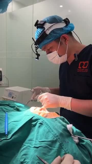 BÁC SĨ ĐIỀN THỰC HIỆN NÂNG MŨI PERFECT DFORM CHO KHÁCH HÀNG