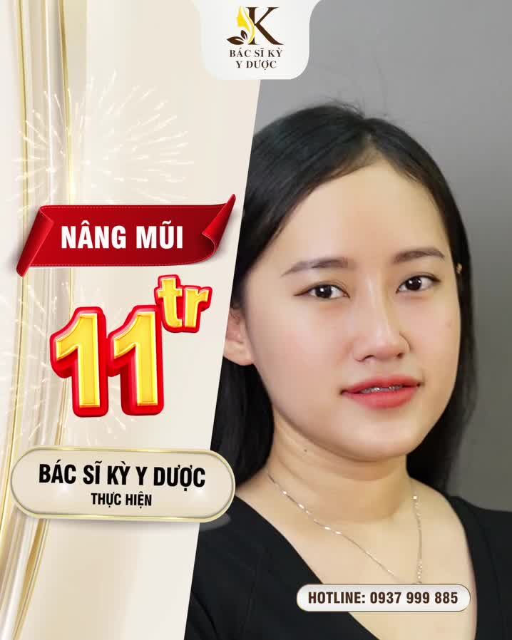 NÂNG MŨI GIÁ GỐC 11TR NGAY TẠI QUẢNG NAM