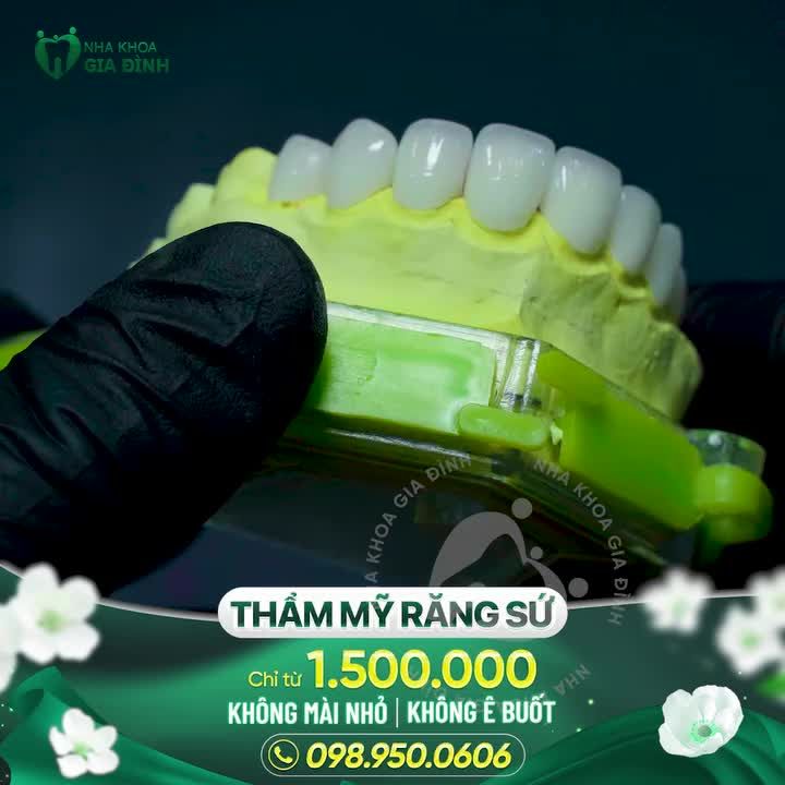 THIẾT KẾ DÁNG RĂNG ĐẸP HOÀN MỸ DÀNH CHO TẤT CẢ KHÁCH HÀNG