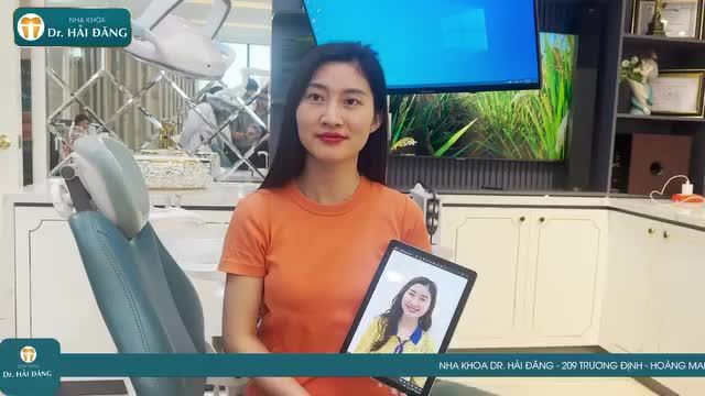 CẢM NHẬN KHÁCH HÀNG CHIA SẺ 2 NĂM NIỀNG RĂNG