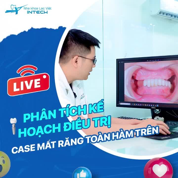 PHÂN TÍCH KẾ HOẠCH ĐIỀU TRỊ CASE MẤT RĂNG TOÀN HÀM TRÊN
