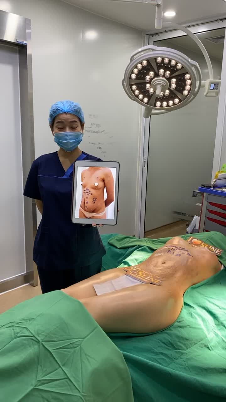 COMBO NÂNG V1 + HÚT MỠ SIẾT EO 360