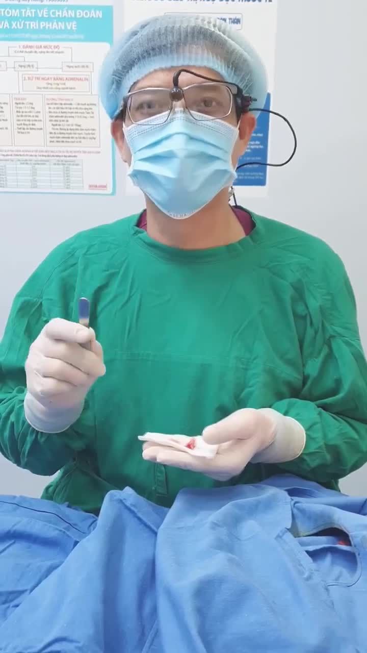 Nâng mũi cấu trúc cứng và Nâng mũi cấu trúc mềm khác nhau như thế nào?