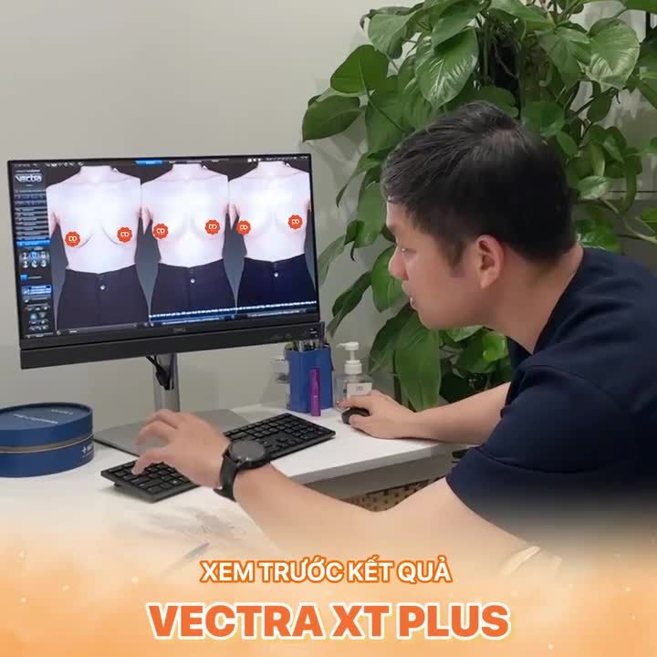 TẬN HƯỞNG ĐẶC QUYỀN KHI NÂNG V1 TẠI DrD