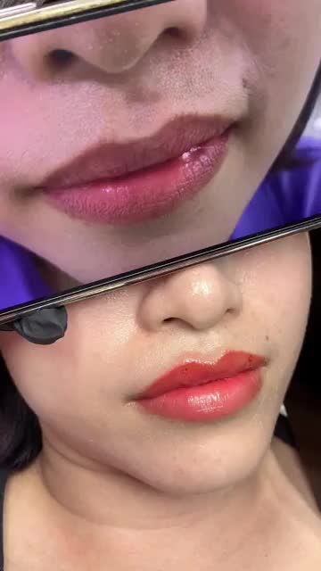 Kết quả phun môi sau 2 ngày bong