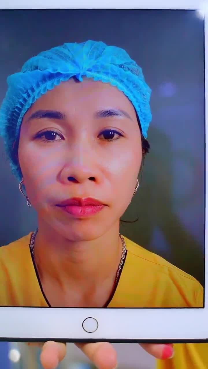 Xem thêm 2407 video Nâng Mũi của bác sĩ Dr Hải Lê