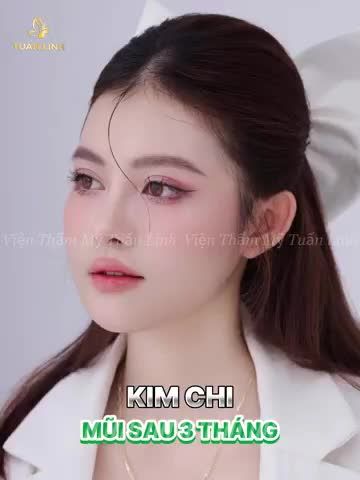 Từ phòng phẫu thuật tới dáng mũi ưng ý!!