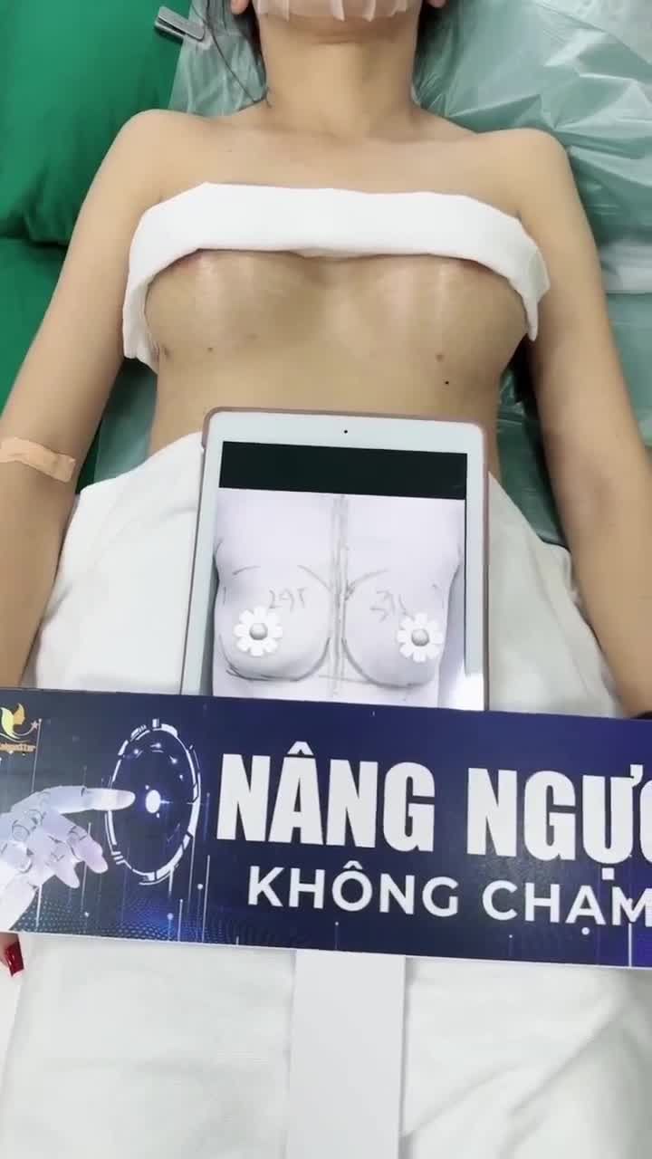 12 NGÀY NÂNG NGỰC KHÔNG CHẠM + THU HẸP "CÔ BÉ" + NÂNG CUNG CHÂN MÀY