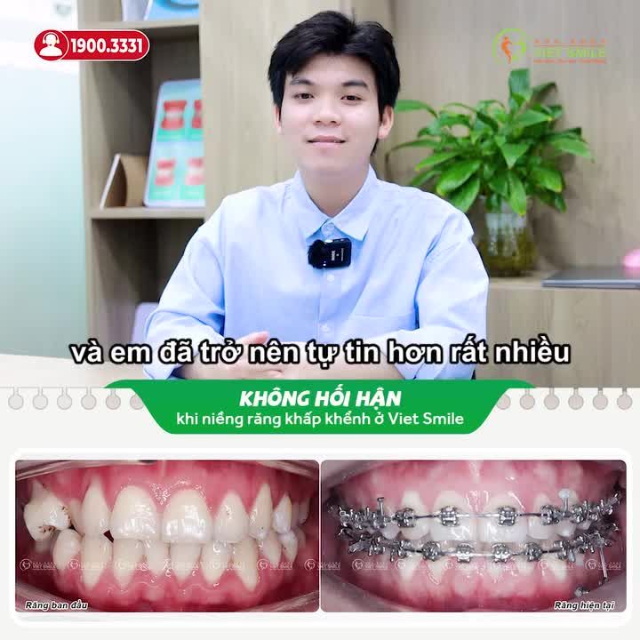 NIỀNG RĂNG SỚM HAY MUỘN QUAN TRỌNG KHÔNG?