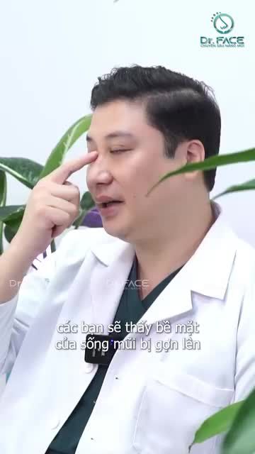 Chọn SILICONE 20 NĂM NỮA mũi bị gì không?