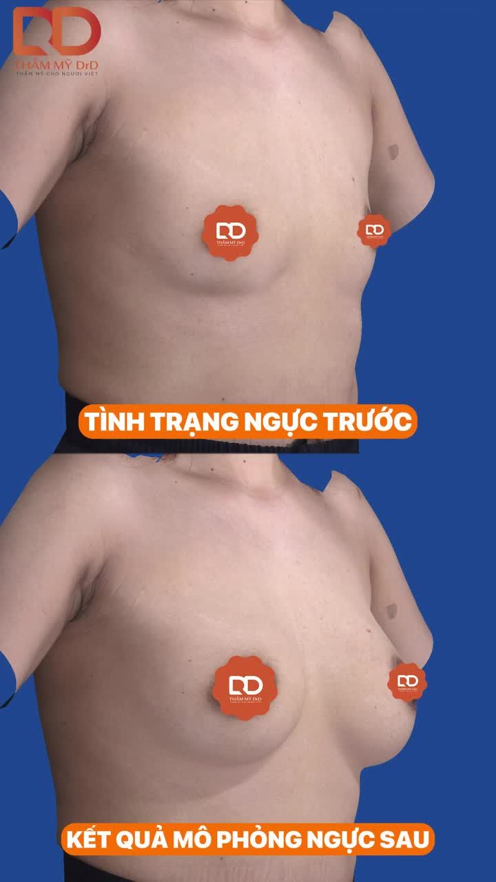 HÀNH TRÌNH BIẾN ĐỔI V1 CỦA KHÁCH HÀNG DRD