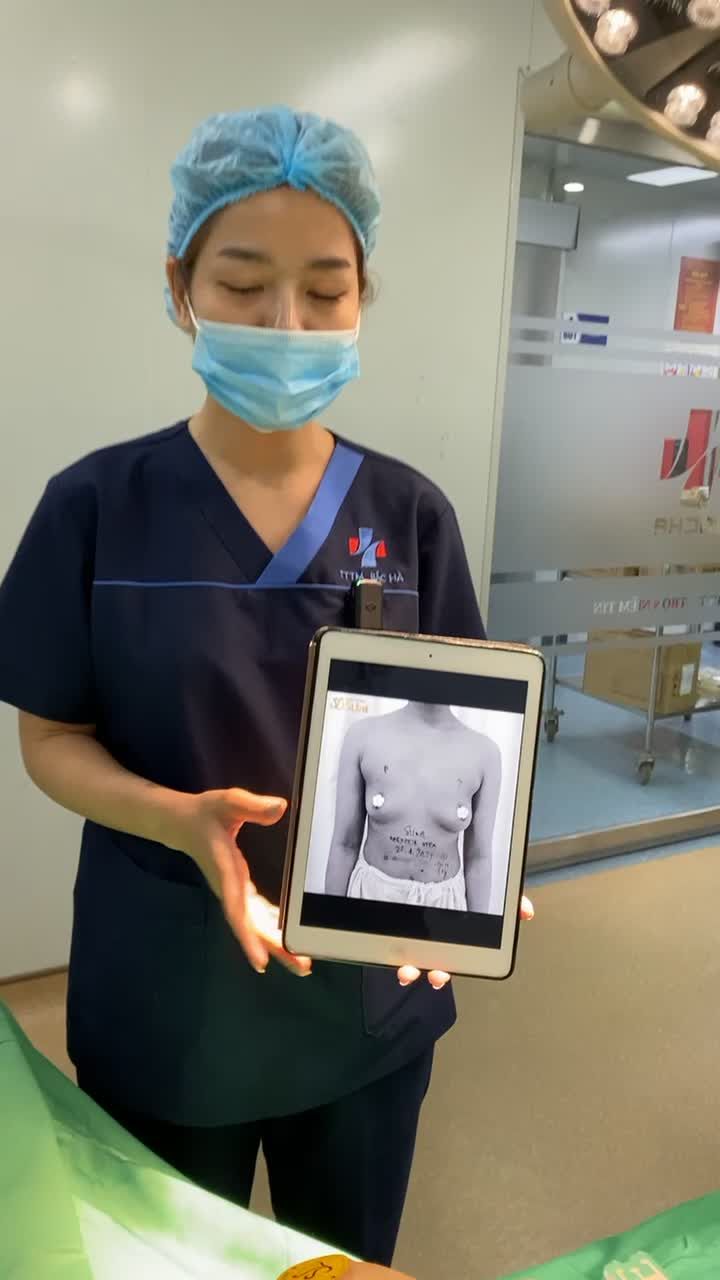THAY ĐỔI VÒNG 1 TEO LÉP SAU SINH CON