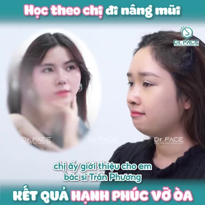 HỌC THEO CHỊ GÁI đi nâng mũi kết quả HẠNH PHÚC VỠ ÒA