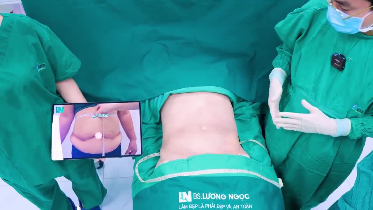 Lấy ra triệt để lượng mỡ khổng lồ của chị khách chỉ sau hơn 1h