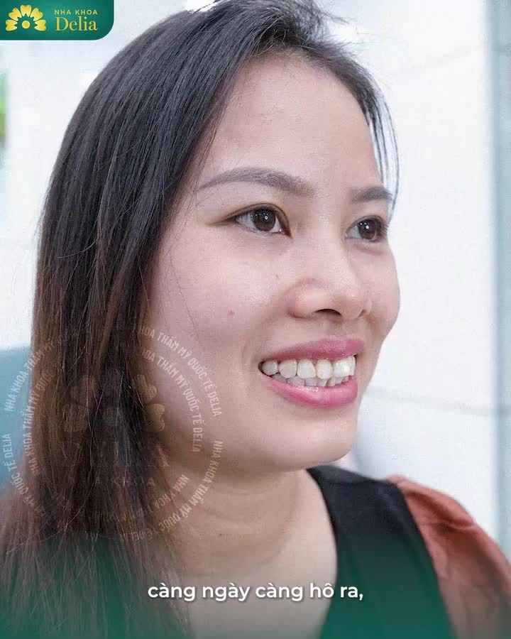 BỌC RĂNG SỨ ĐÃ LÀM THAY ĐỔI CUỘC SỐNG CỦA CHỊ EM NHƯ THẾ NÀO?